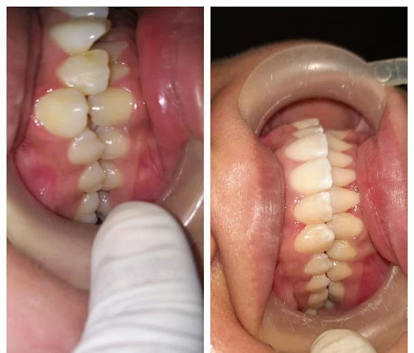 Pooja Smile Care Dental Gallery Image 27